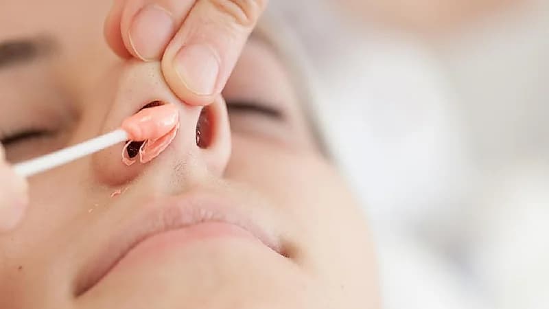 طبيب: نتف شعر الأنف قد يصيبك بأمراض خطيرة