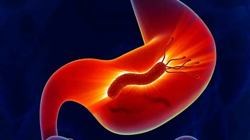 استشاري يحدد الأطعمة المسموح بتناولها قبل تحليل جرثومة المعدة