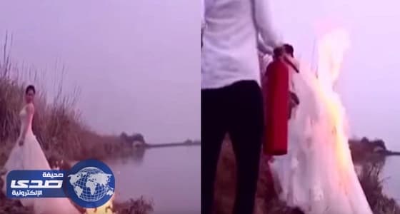 الربيعة: عملية فصل التوأم الفلسطيني تسير بنجاح