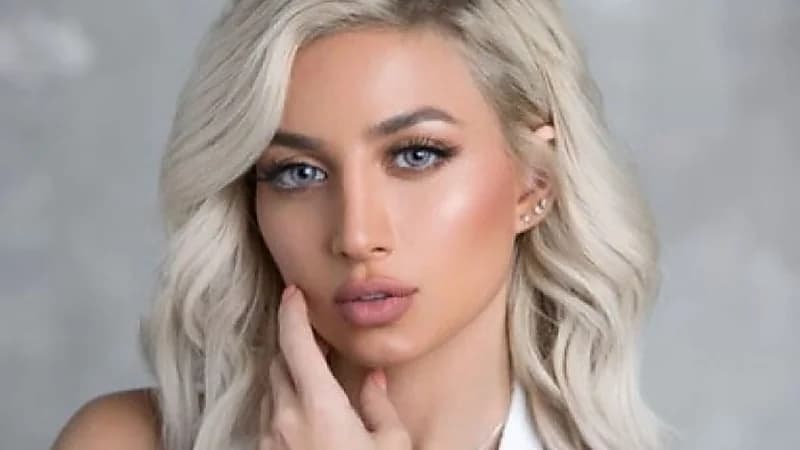 مودل روز عن اتهام طليقها بضربه : " وجه متنفخ من عملية زراعة الشعر"