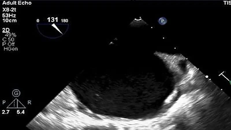 إنقاذ حياة مريضة حامل تعاني من القلب