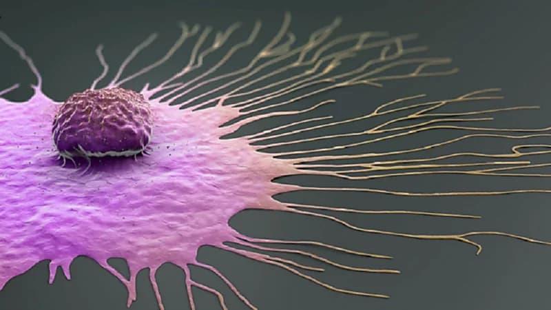 أخصائي أورام يوضح سبب إصابة الرجال بسرطان الثدي