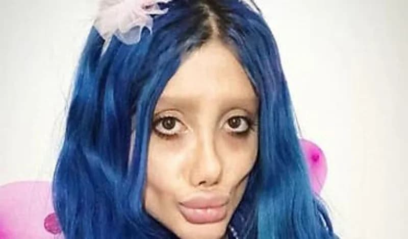 تشبه الزومبي.. أنجلينا جولي إيران تكشف سر وجهها المرعب