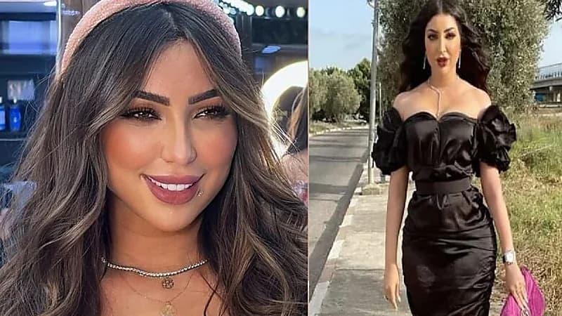 دنيا بطمة تتعرض للانتقاد بعد إجراء تجميلي جديد في وجهها