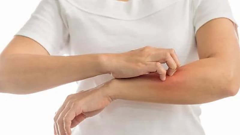 مختص: التوتر قد يتسبب في الحكة والطفح الجلدي