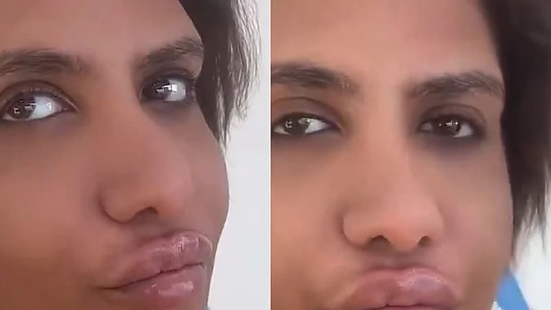 ريم البلوشي تشارك مقطع بعد إجرائها لعملية تجميل .. فيديو