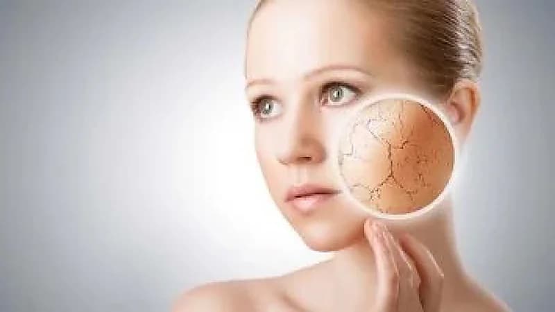 أسباب الشعور بالصداع والتعب فى الشتاء