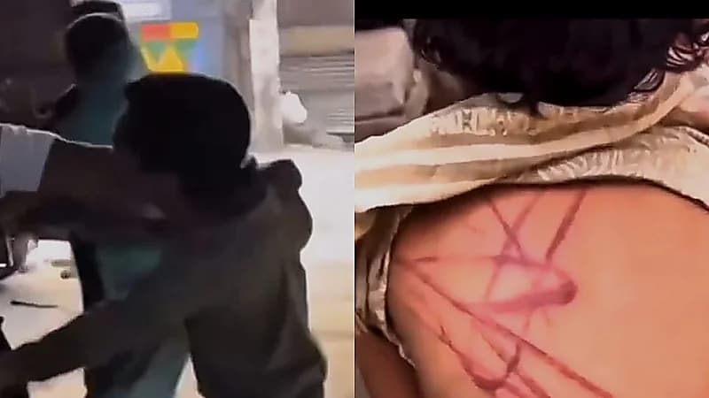 مارة يضربون ويجرون والدًا في الشارع بعد اكتشاف تعذيبه لطفلته .. فيديو