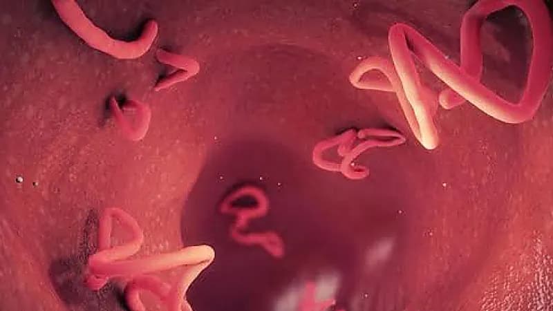 علامات تحذيرية خطيرة تدل على الإصابة بالديدان الخطافية والشريطية