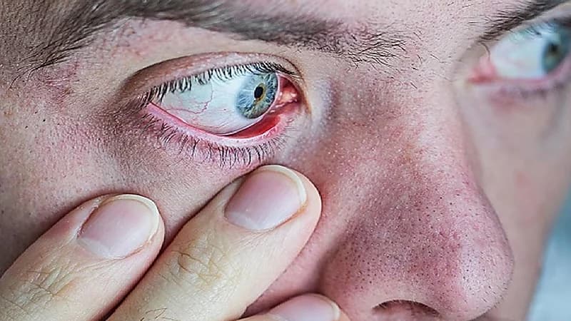 علامات في العين تكشف عن أعراض مبكرة للخرف