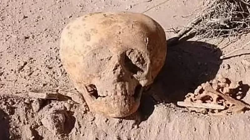 جمجمة غريبة تثير الجدل في الأرجنتين