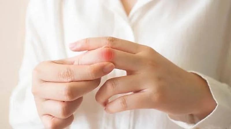 الكشف عن أبرز أسباب انتفاخ اليدين عند الاستيقاظ