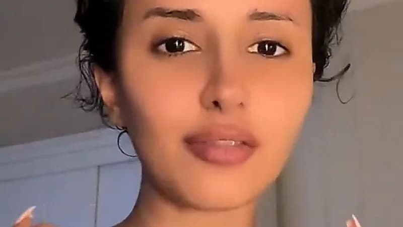 فتاة تحذر من فيلر الشفاه: دوامة لا تنتهي ..فيديو