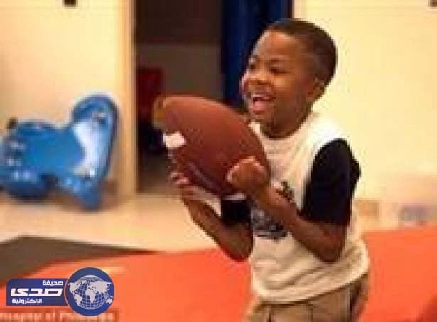 بالفيديو.. تجربة أول طفل يحصل على عملية زراعة مزدوجة للذراعين