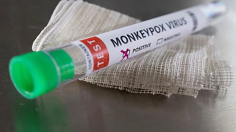 حجب تغريدة لمسؤول مغربي سابق ربطت بين جدري القرود والمثلية