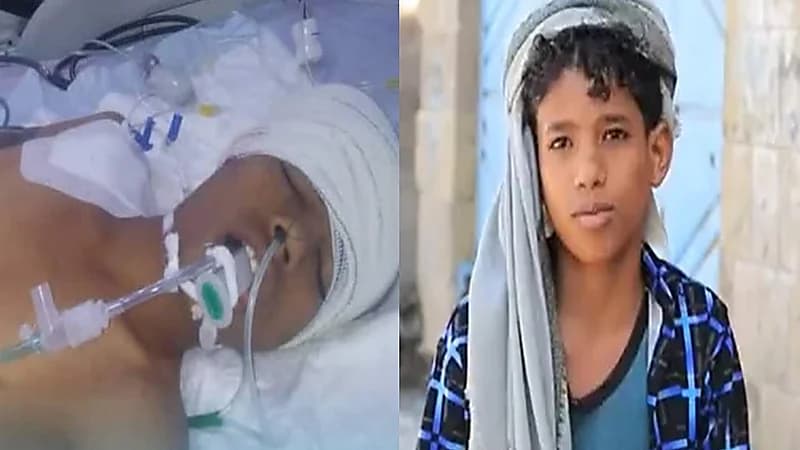 "هذه المرة في رأسه" قناص حوثي يستهدف طفلًا يمنيًا للمرة الثانية