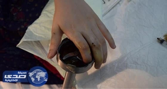 مدني الرياض ينقذ يد امرأة من فرامة