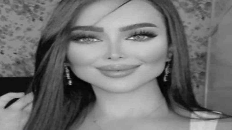 سوسن هارون تثير ضجة بين جمهورها بعد عملية التجميل الأخيرة