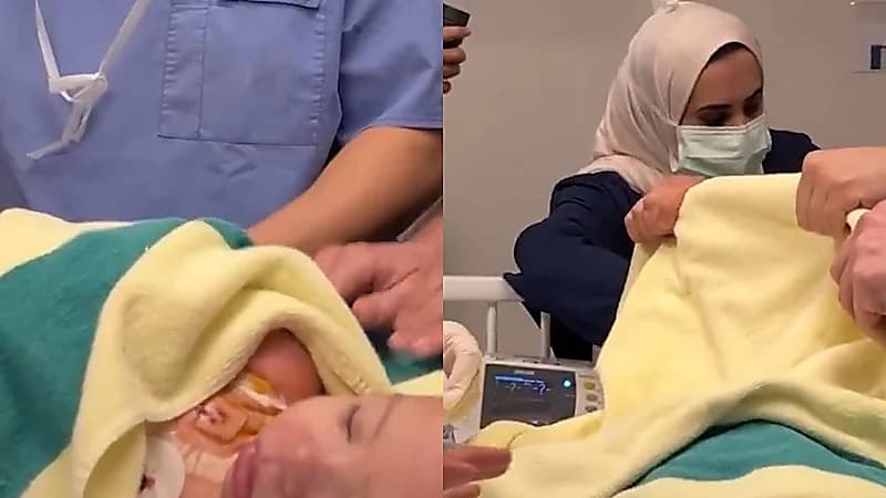 نقل الطفل المصري إلى غرفة الملاحظات بعد نجاح عملية فصل.. فيديو