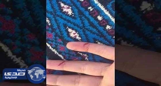 بالفيديو..تعليم المدينة المنورة:واقعة ضرب طالبة صحيحة وموظفة إدارية ارتكبتها